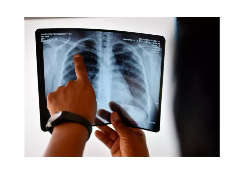 Pakistan Among Top 8 Nations Driving Global TB Crisis