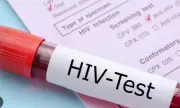 Islamabad HIV Cases Surge: 618 New Infections Reported in 15-Month Period