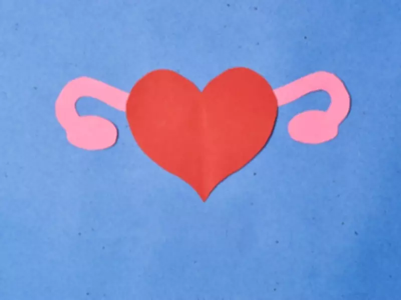 PCOS Renamed to PMOS: A Landmark Change After 14 Years