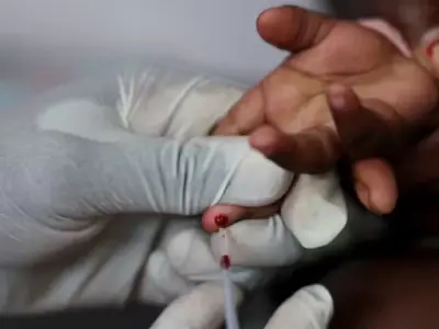 SHC Orders Report on HIV Outbreak Among 200 Children in Karachi